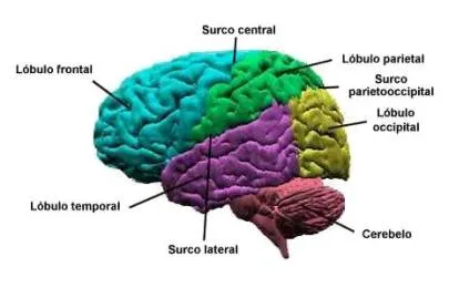 Anatomía en la malformación de Arnold Chiari - Artículo de ...