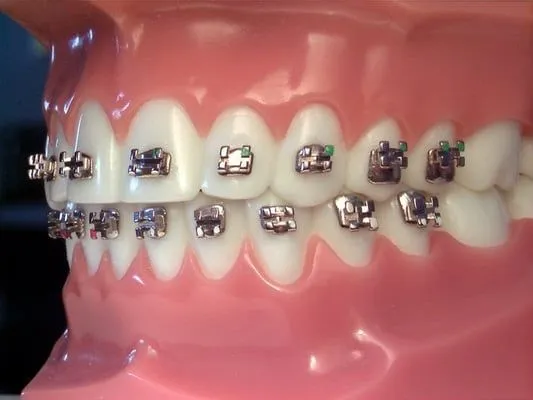 Imagenes de brackets de Hello Kitty - Imagui