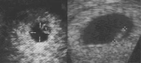 Infogen | Ultrasonido