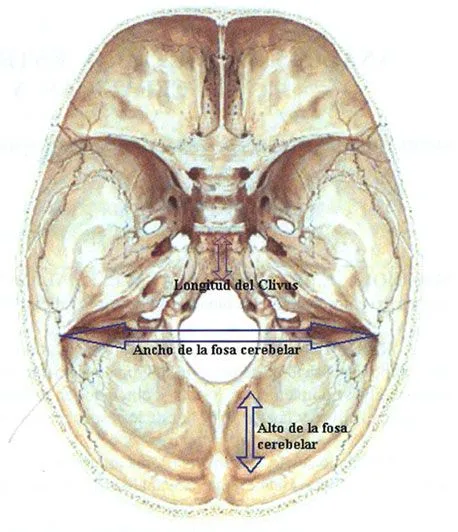 International Journal of Morphology - ANÁLISIS BIOMÉTRICO ENTRE ...