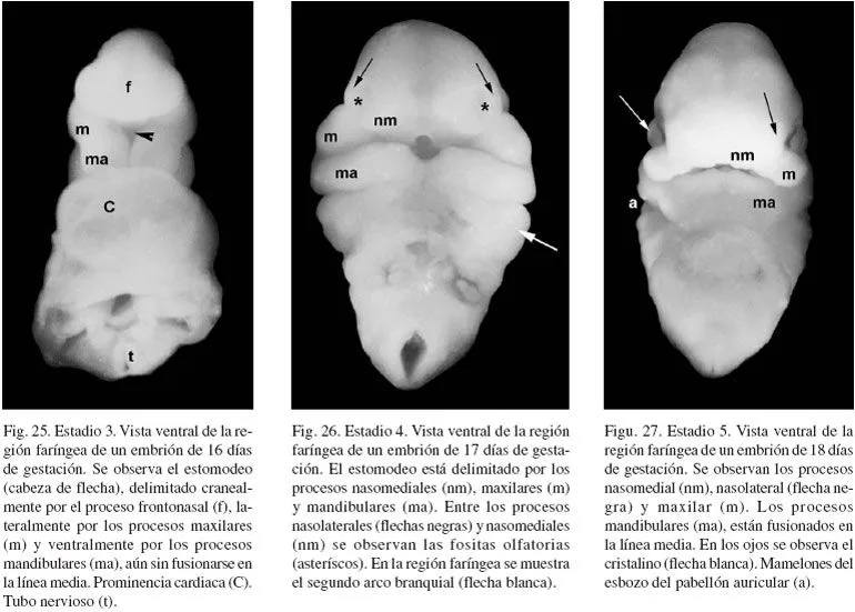 International Journal of Morphology - Análisis Macroscópico y ...