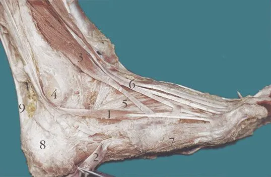 International Journal of Morphology - MÚSCULO FIBULAR DEL DEDO MÍNIMO