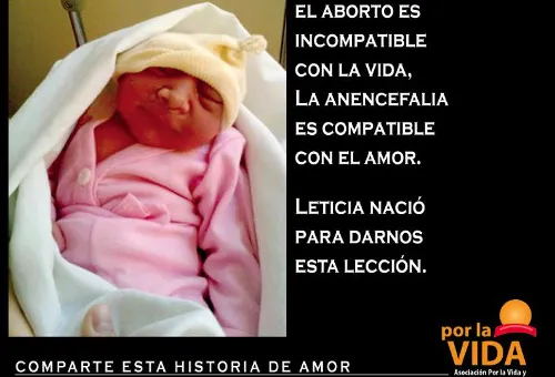 Lanzan campaña para sensibilizar sobre aborto de bebés con anencefalia