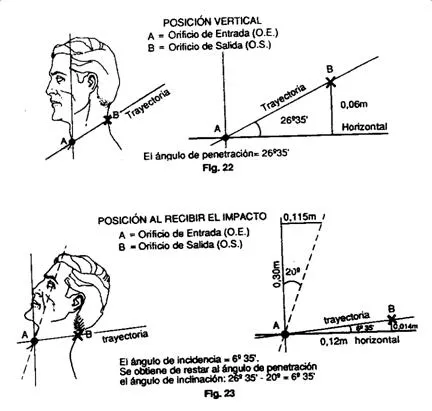 Lesión por arma de fuego corta (página 3) - Monografias.com