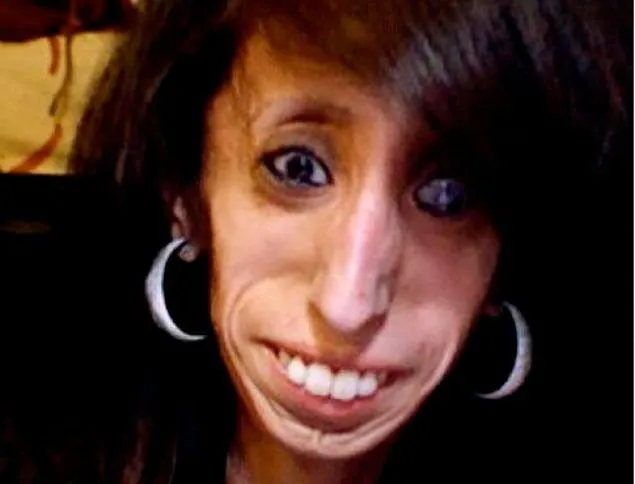 Lizzie Velasquez – Amenzing