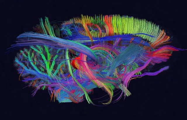 El primer mapa del cerebro en 3D está en marcha. | Aula Geek