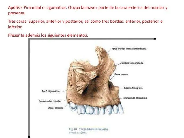 Maxilar Superior