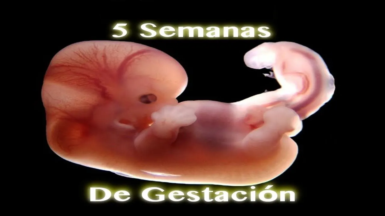 Milagro De Gestación - 5 Semanas De Gestación - YouTube