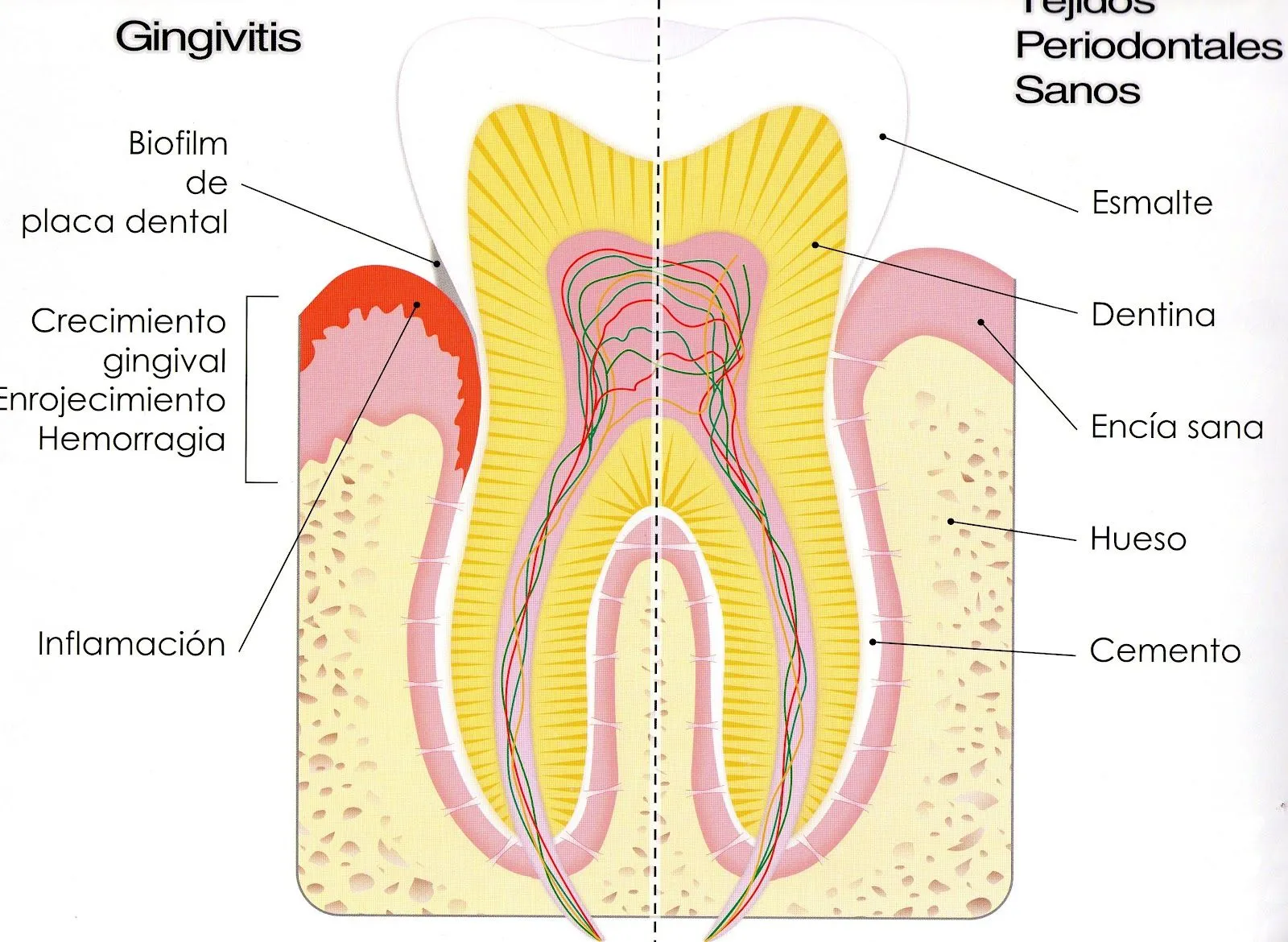 Así es mi molar (muela) por dentro | PREVENCION BUCAL