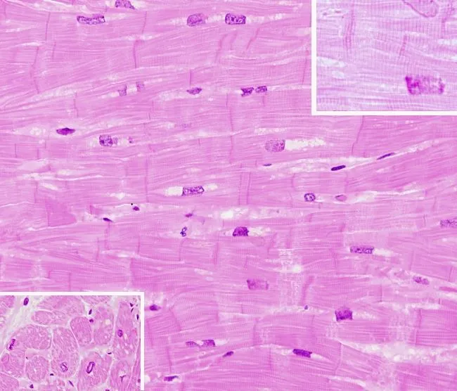 Muscular: cardiaco. Atlas de Histología Vegetal y Animal