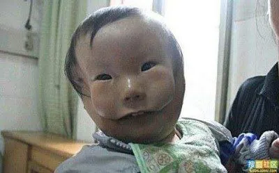 Nace un niño en China con dos caras