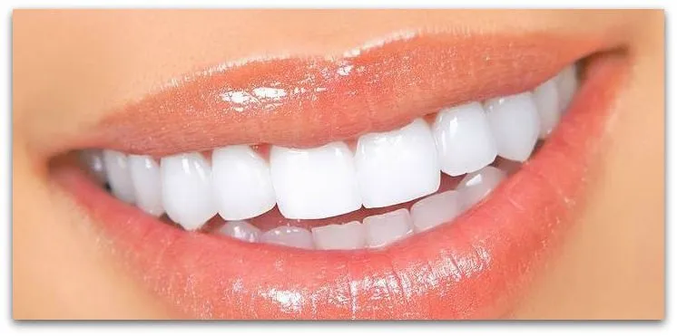 Naturally Whiten Teeth with These Home Remedies - Health Extremist