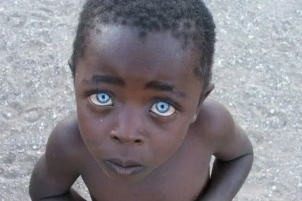 Niño negro con ojos azules… | AlcarrizosDigital.Net