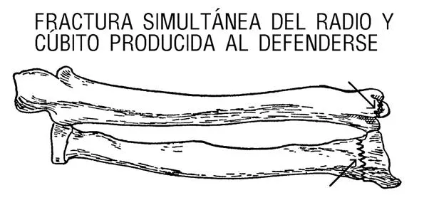 Notas de antropología para medicos forenses (página 4 ...