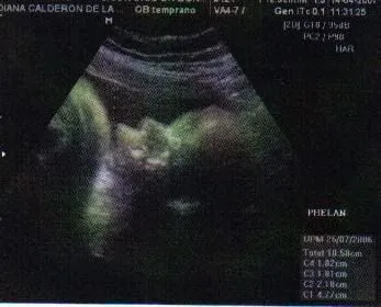  ... que tengo osea 37 3 ya esta a dias de nacer mi hermoso bebe o beba