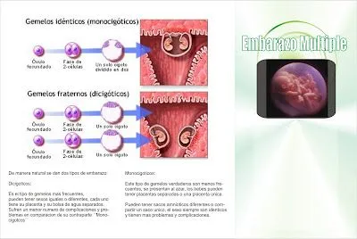 ParrixV: Embarazo Multiple