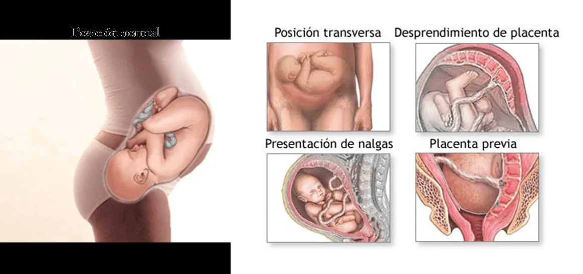 Parto y cesarea | Vamos Hablando Claro