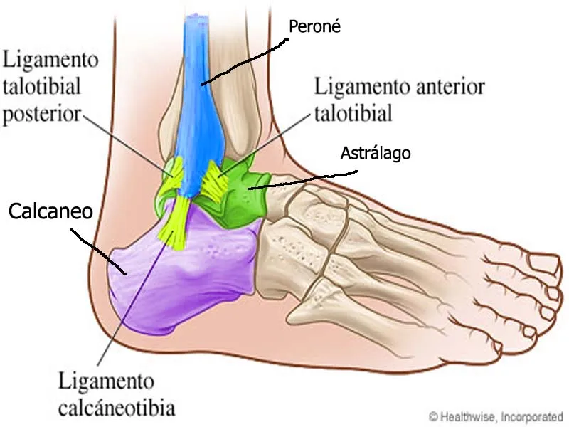 Patología e Imagenología simple: Ligamentos afectados y tipos de ...