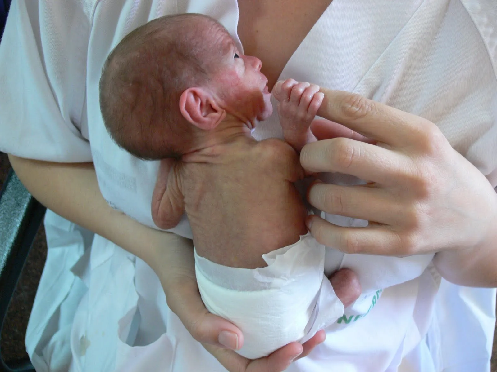 UCI Neonatal » Weblogs Sanitarios en Español