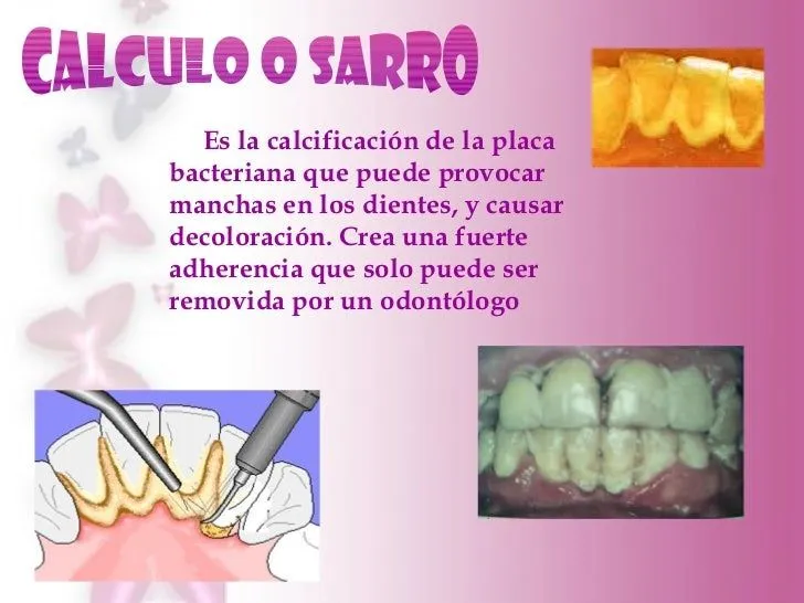 presentacion-enfermedad- ...