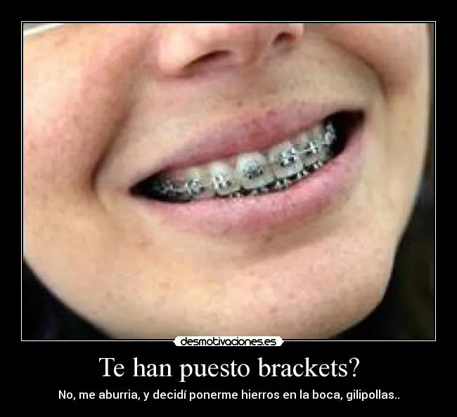 Te han puesto brackets? | Desmotivaciones