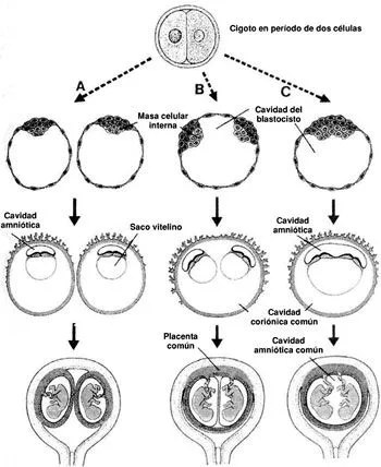 Revista chilena de obstetricia y ginecología - GEMELAR ...