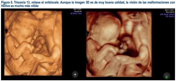 Revista Peruana de Ginecología y Obstetricia - Alta definición ...