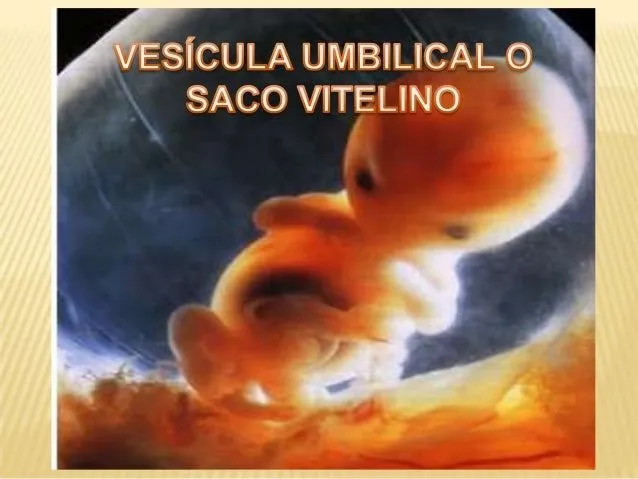 Saco vitelino