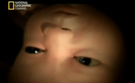 Bebés de 27 semanas de gestacion - Imagui