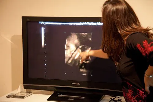 Desarrollo de un embarazo de nueve semanas