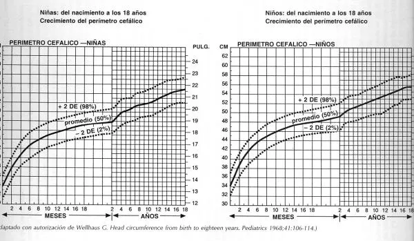 Semiología pediátrica de la cabeza - Monografias.