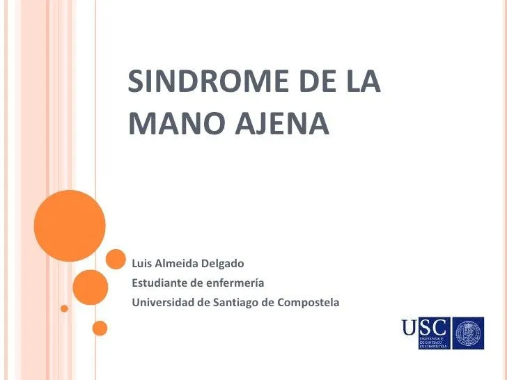 Sindrome de la mano ajena