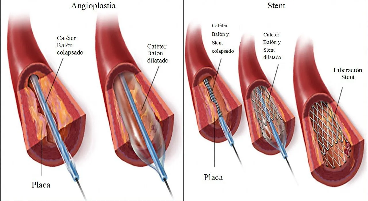 Sistema Circulatorio