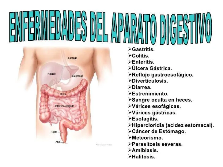 Sistema digestivo enfermedades