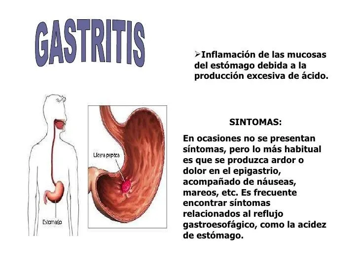 Sistema digestivo enfermedades