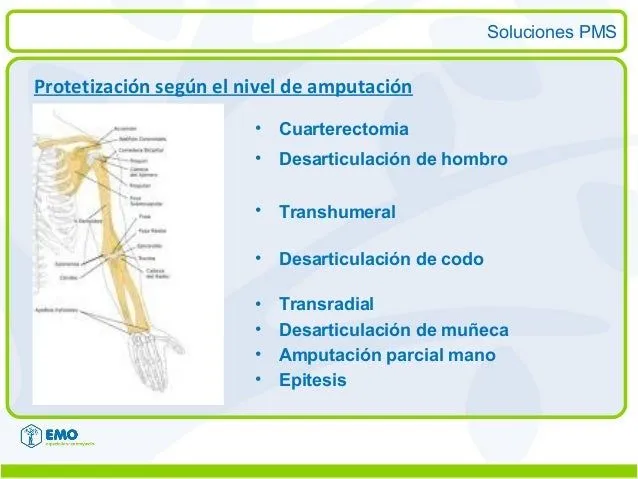 soluciones-pms-emo-4-638.jpg? ...