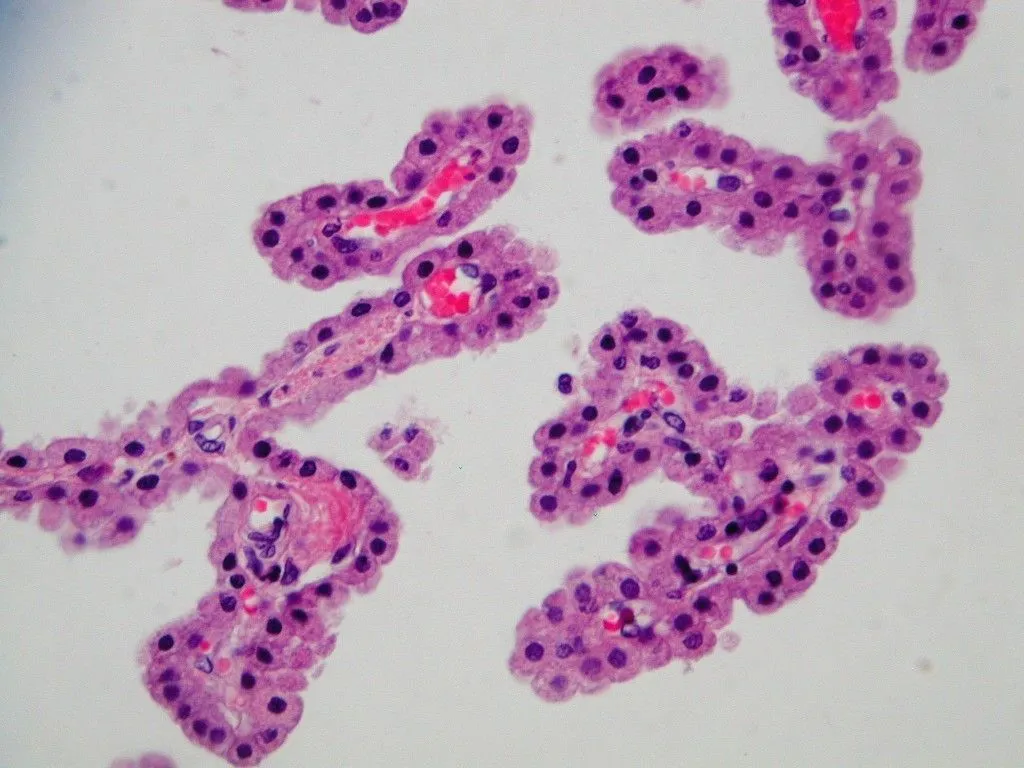 SOS BIOLOGIA CELULAR Y TISULAR: TEJIDO NERVIOSO