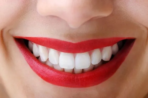 Teeth Whitening Treatments | London | Moorgate | UK