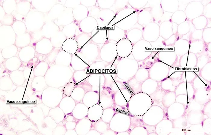 Tejido adiposo blanco