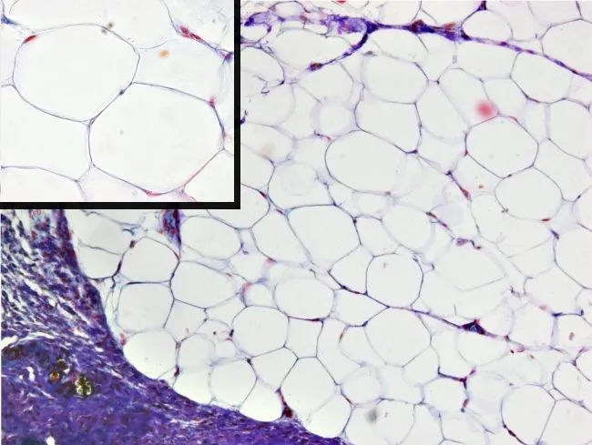 Tejido adiposo. Atlas de Histología Vegetal y Animal