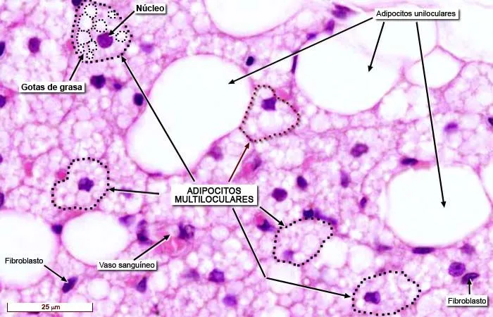 Tejido adiposo pardo