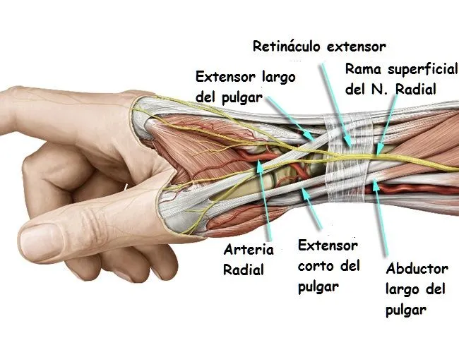 Tendinitis de D´quervain