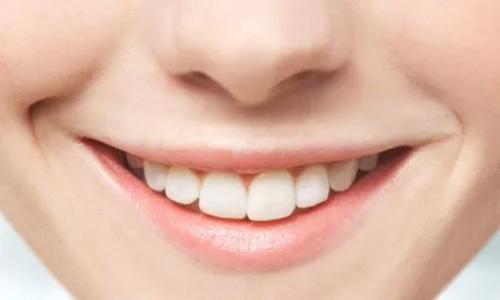 The inside track . . . on teeth whitening | Life and style | The ...