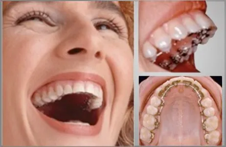 Tratamientos dentales - Dental Bugambilias