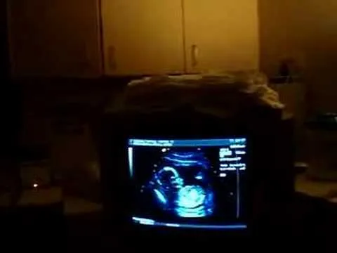 Ultrasonido De 4 Meses Miooo - VidoEmo - Emotional Video Unity