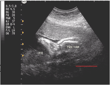 medio de un ultrasonido prenatal a las 16 semanas de gestacion