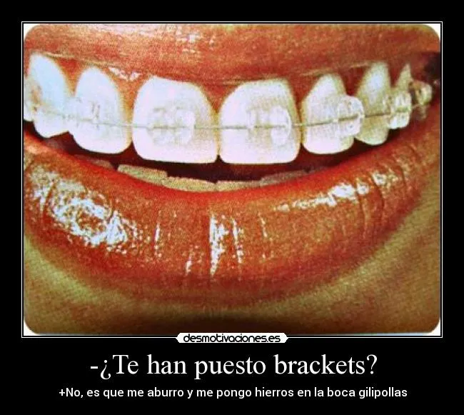 Brackets de colores bonitos - Imagui