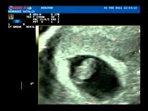 Como se ve un bebé de 7 semanas - Imagui