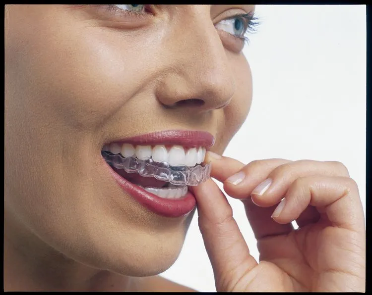 Ventajas de la ortodoncia invisible Invisalign® | BLOG DE ORTODONCIA