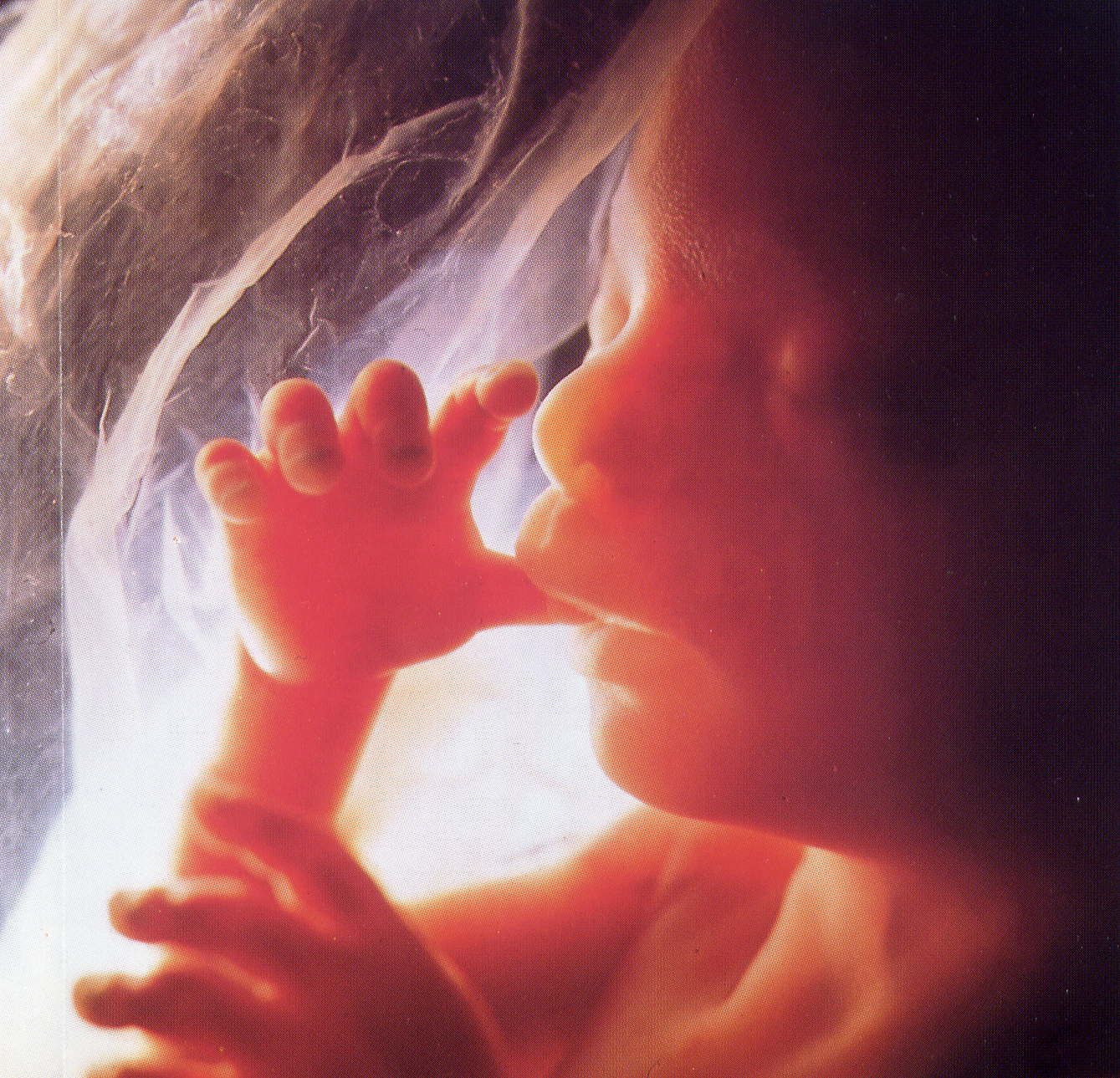 Z.Love's Entertainment Blog: Abortion is the American Holocaust ...